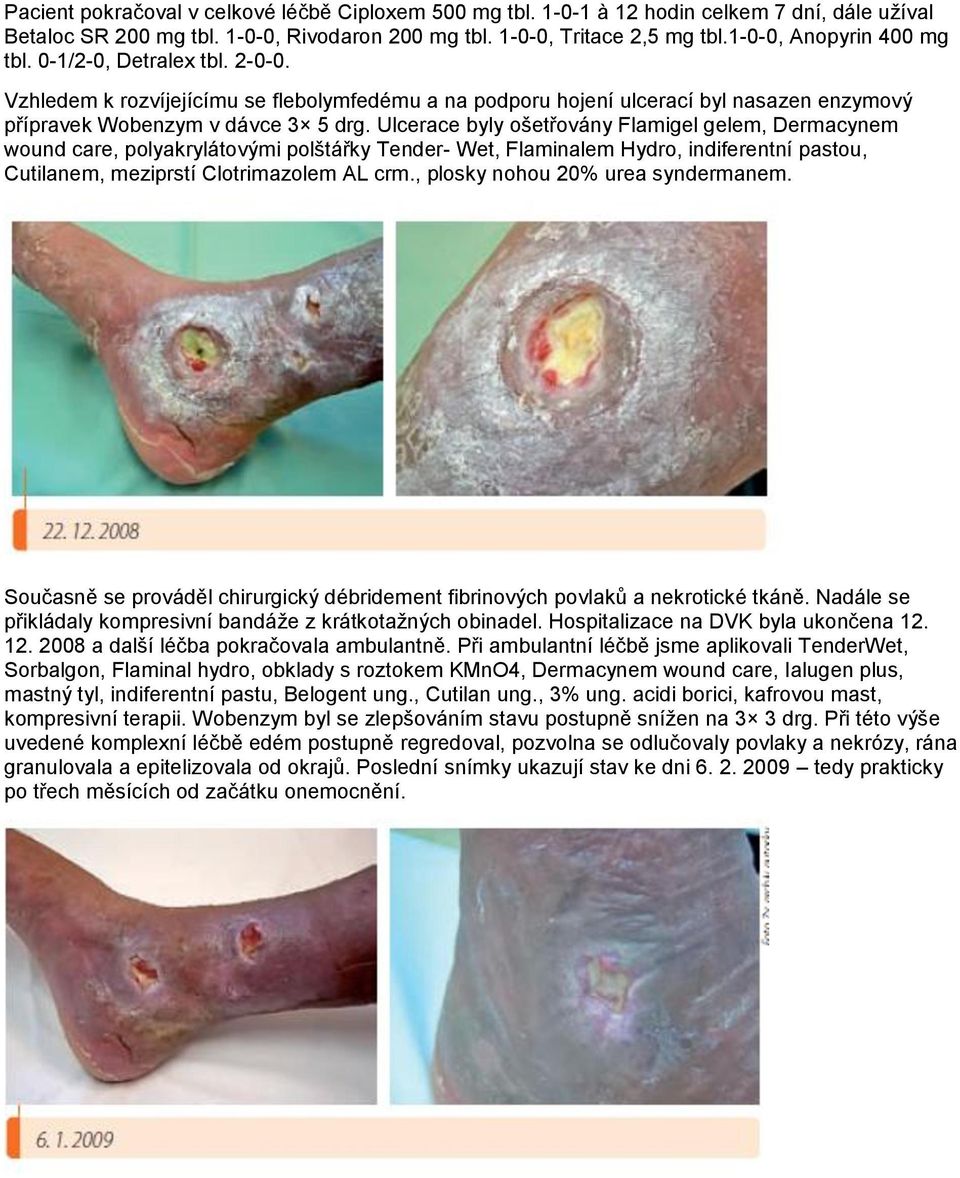 Ulcerace byly ošetřovány Flamigel gelem, Dermacynem wound care, polyakrylátovými polštářky Tender- Wet, Flaminalem Hydro, indiferentní pastou, Cutilanem, meziprstí Clotrimazolem AL crm.