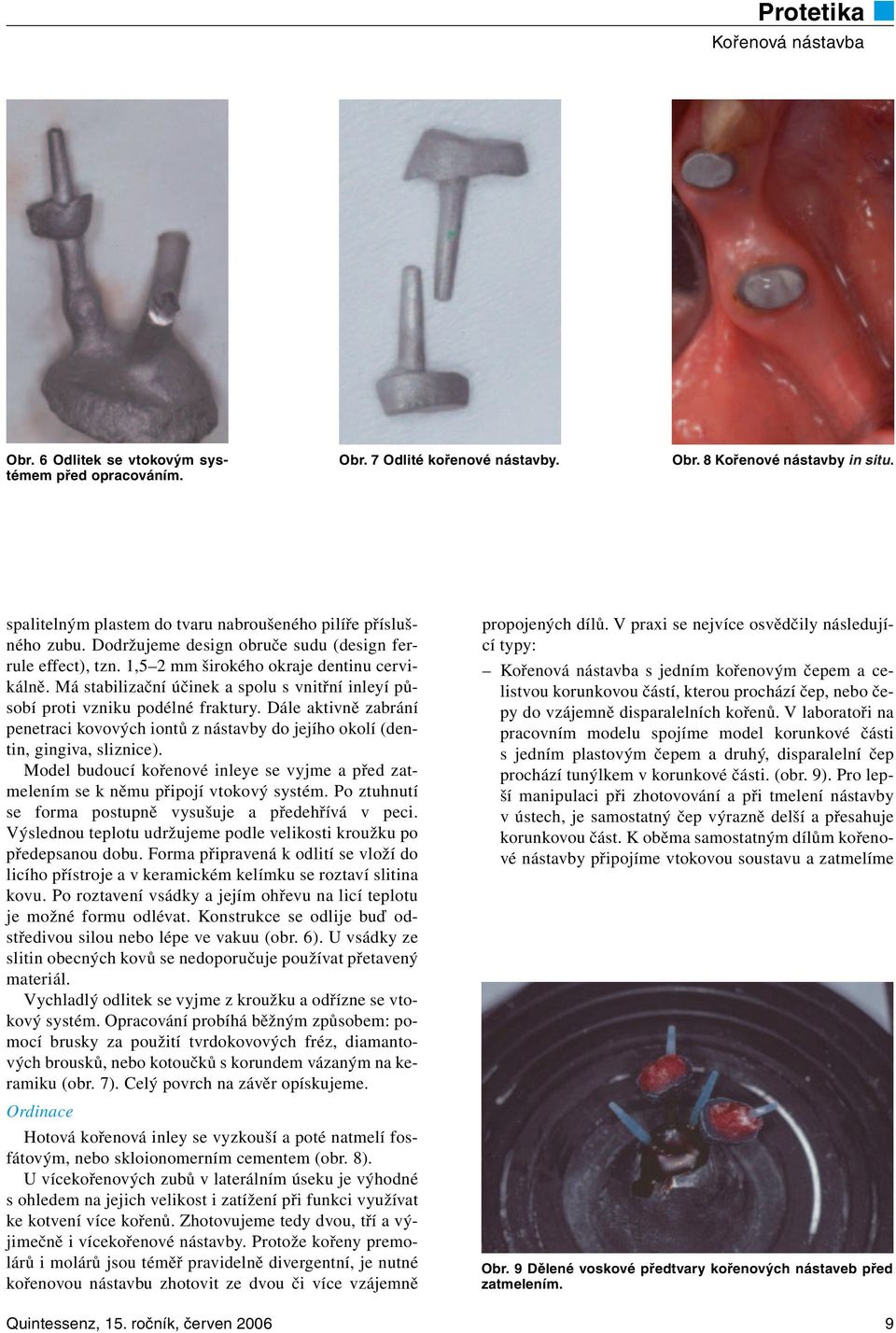 Dále aktivně zabrání penetraci kovových iontů z nástavby do jejího okolí (dentin, gingiva, sliznice). Model budoucí kořenové inleye se vyjme a před zatmelením se k němu připojí vtokový systém.