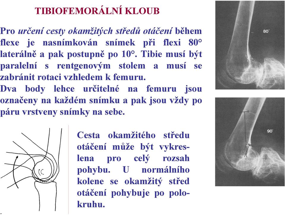 Dva body lehce určitelné na femuru jsou označeny na každém snímku a pak jsou vždy po páru vrstveny snímky na sebe.