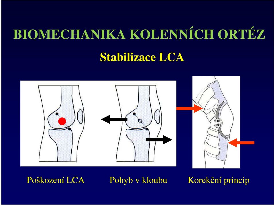 Poškození LCA Pohyb v