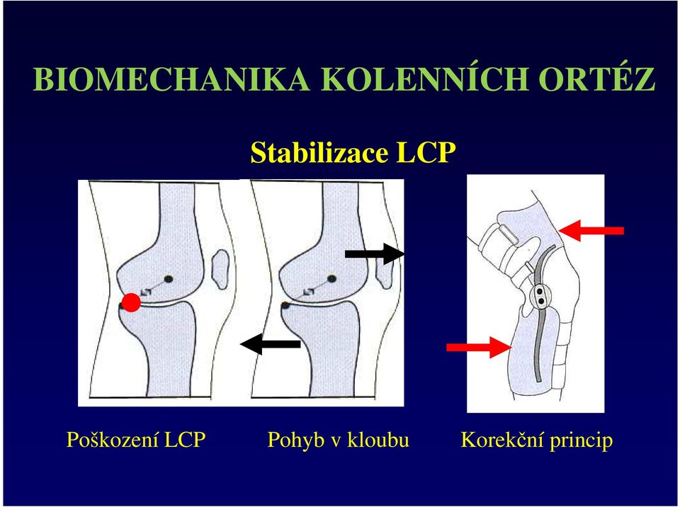 Poškození LCP Pohyb v