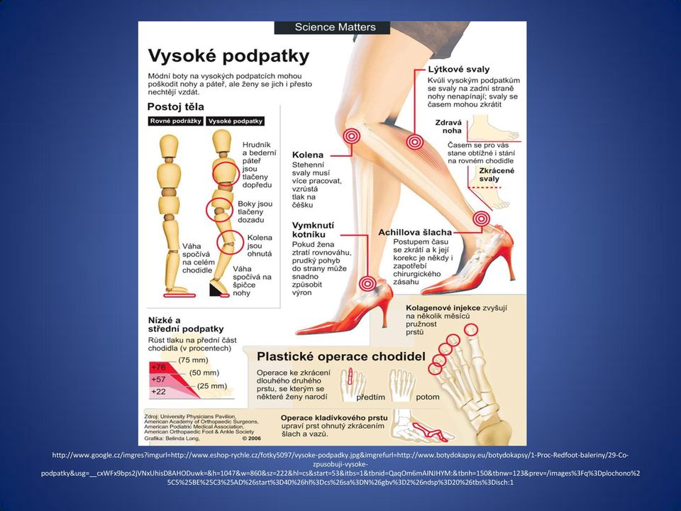 eu/botydokapsy/1-proc-redfoot-baleriny/29-cozpusobuji-vysokepodpatky&usg=