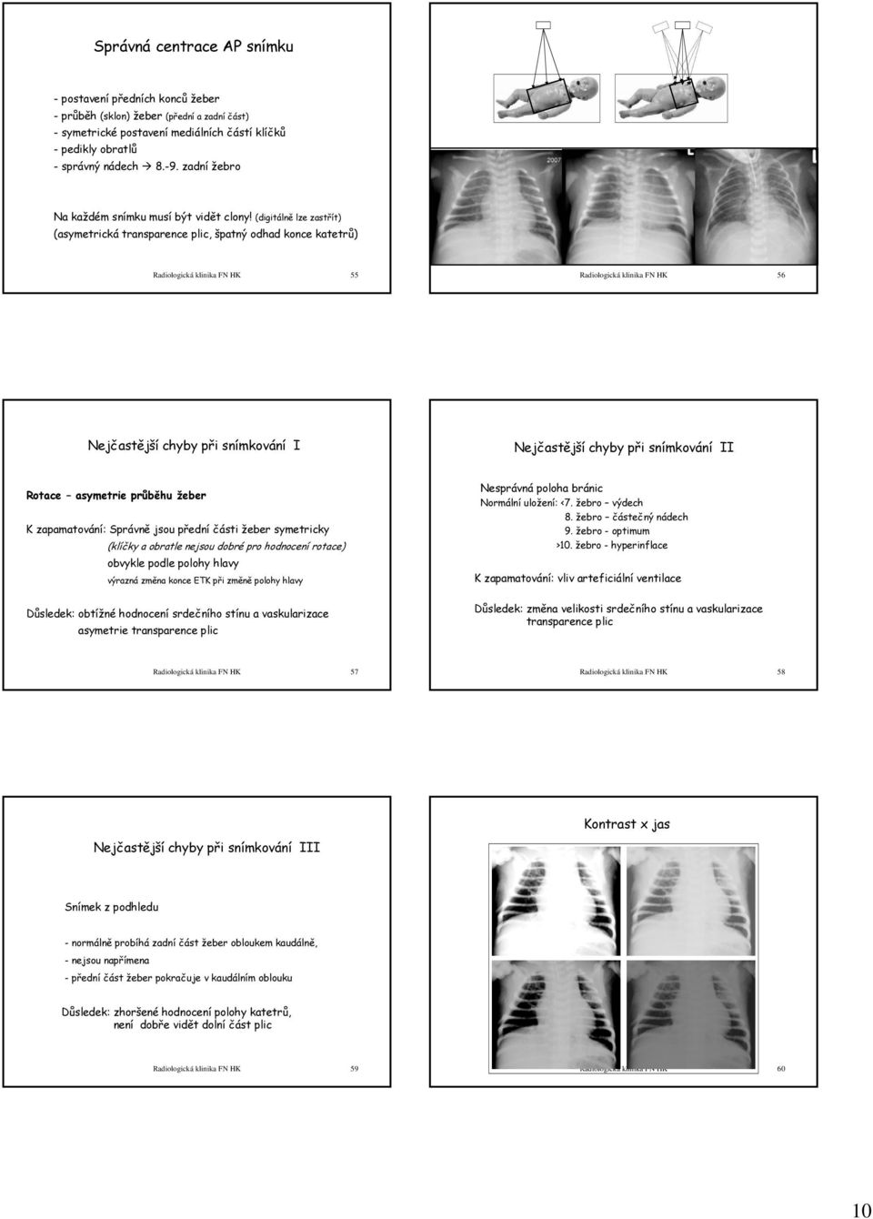 (digitálně lze zastřít) (asymetrická transparence plic, špatný odhad konce katetrů) Radiologická klinika FN HK 55 Radiologická klinika FN HK 56 Nejčastější chyby při snímkování I Nejčastější chyby