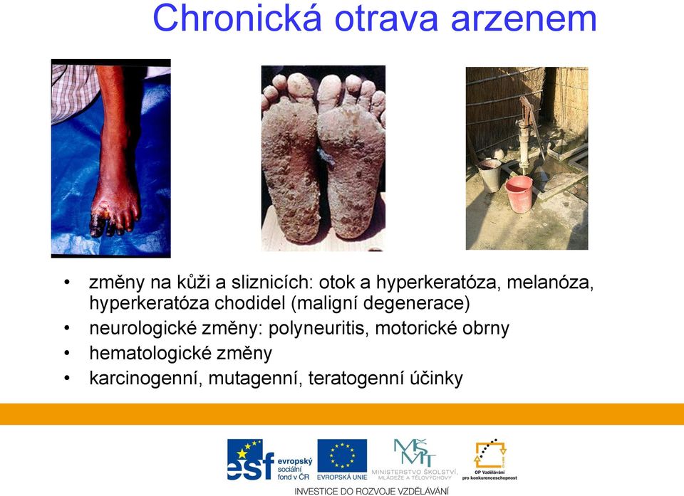 degenerace) neurologické změny: polyneuritis, motorické