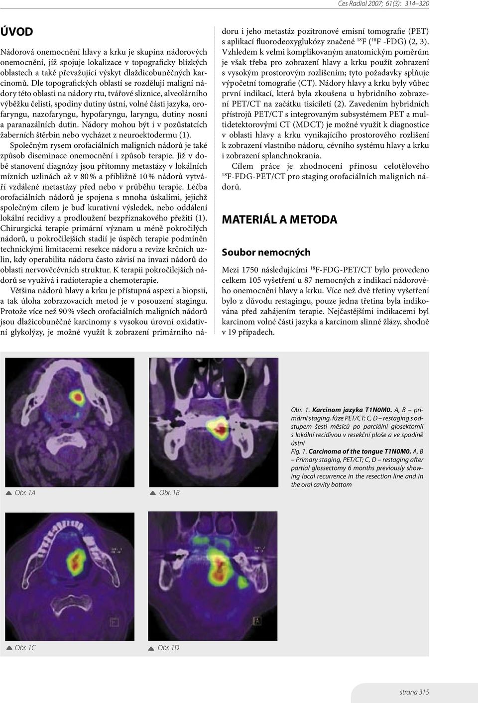 hypofaryngu, laryngu, dutiny nosní a paranazálních dutin. Nádory mohou být i v pozůstatcích žaberních štěrbin nebo vycházet z neuroektodermu (1).