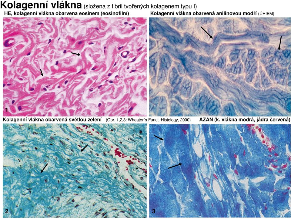 anilinovou modří (ÚHIEM) 1 Kolagenní vlákna obarvená světlou zelení (Obr.