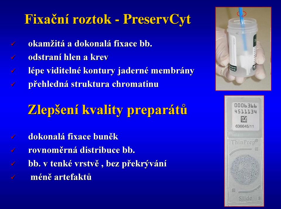 přehledná struktura chromatinu Zlepšení kvality preparátů dokonalá