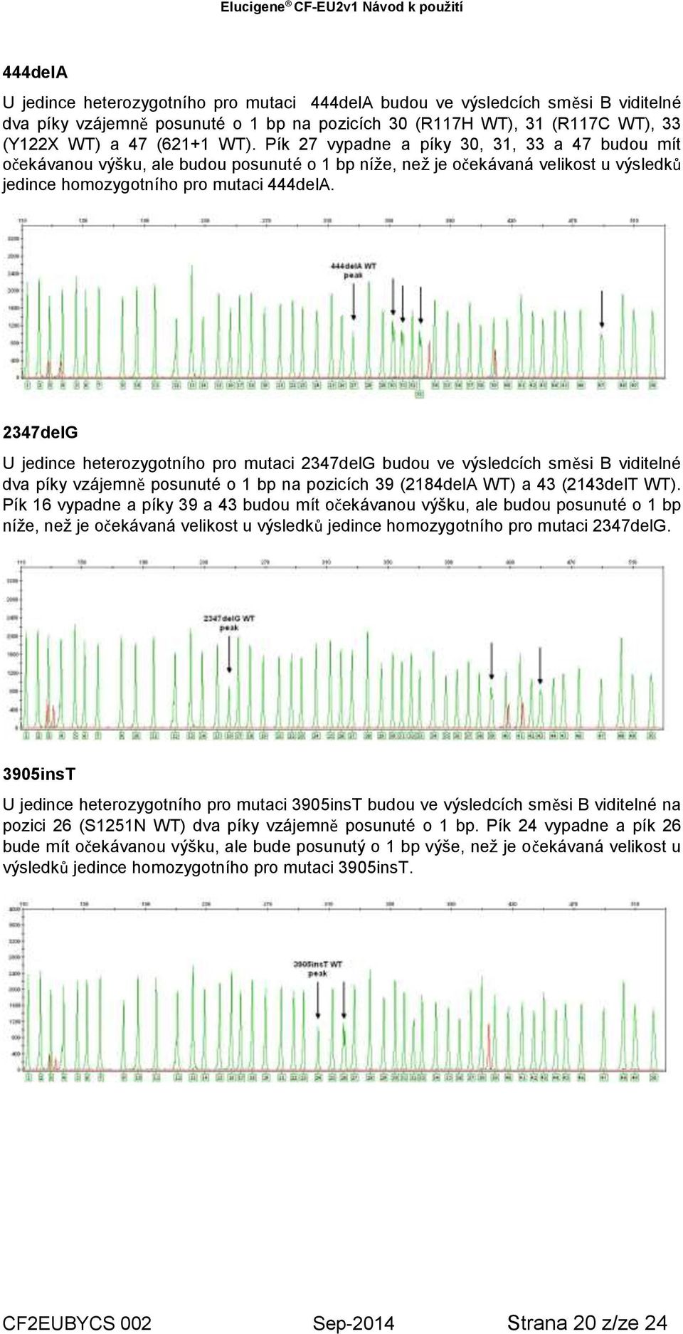 2347delG U jedince heterozygotního pro mutaci 2347delG budou ve výsledcích směsi B viditelné dva píky vzájemně posunuté o 1 bp na pozicích 39 (2184delA WT) a 43 (2143delT WT).