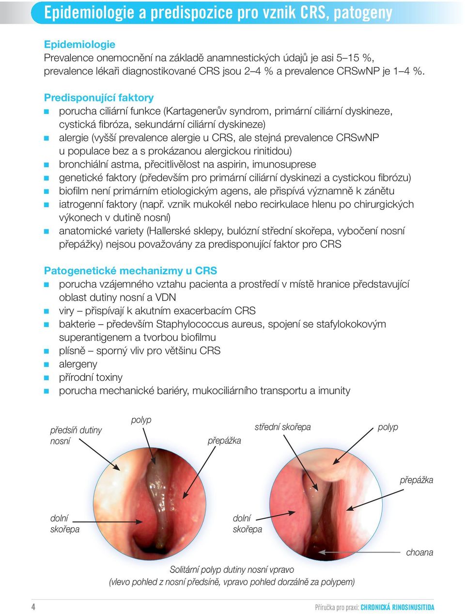 Predisponující faktory porucha ciliární funkce (Kartagenerův syndrom, primární ciliární dyskineze, cystická fibróza, sekundární ciliární dyskineze) alergie (vyšší prevalence alergie u CRS, ale stejná