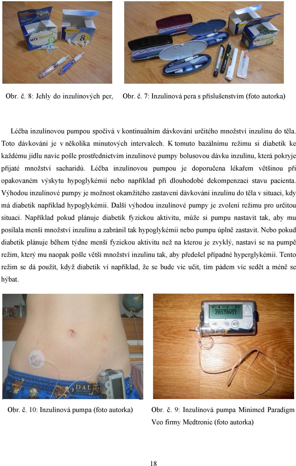 K tomuto bazálnímu režimu si diabetik ke každému jídlu navíc pošle prostřednictvím inzulínové pumpy bolusovou dávku inzulínu, která pokryje přijaté množství sacharidů.