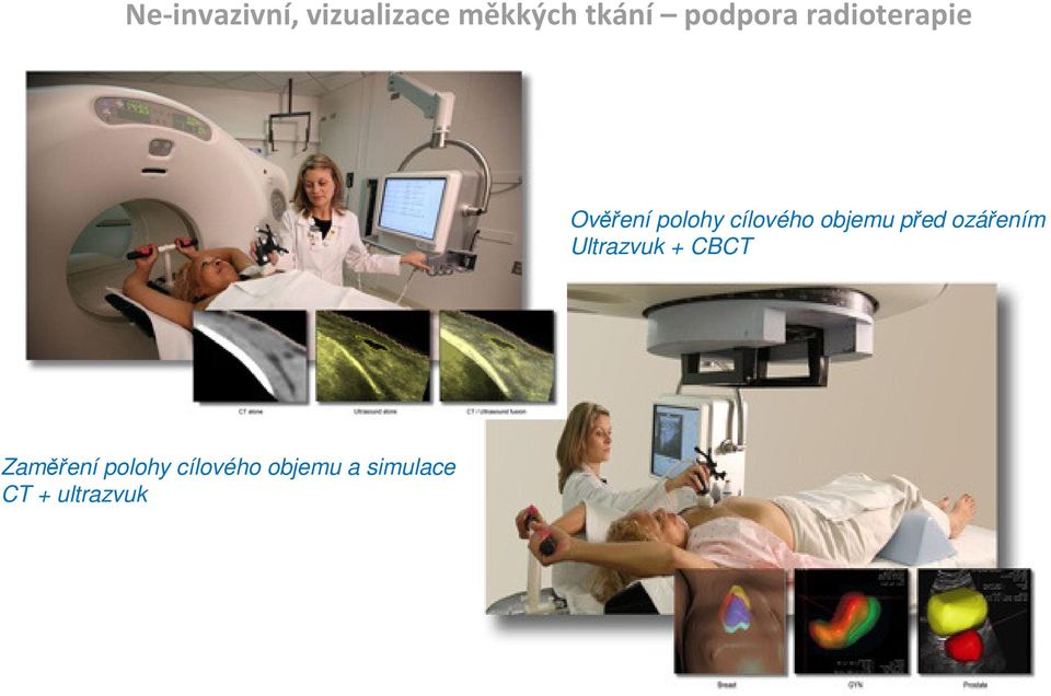 objemu před ozářením Ultrazvuk + CBCT