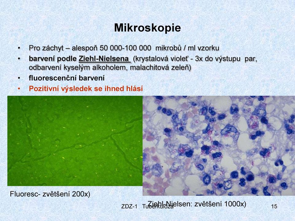 alkoholem, malachitová zeleň) fluorescenční barvení Pozitivní výsledek se