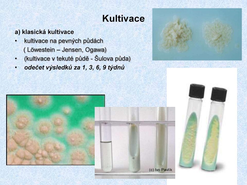 (kultivace v tekuté půdě - Šulova půda)