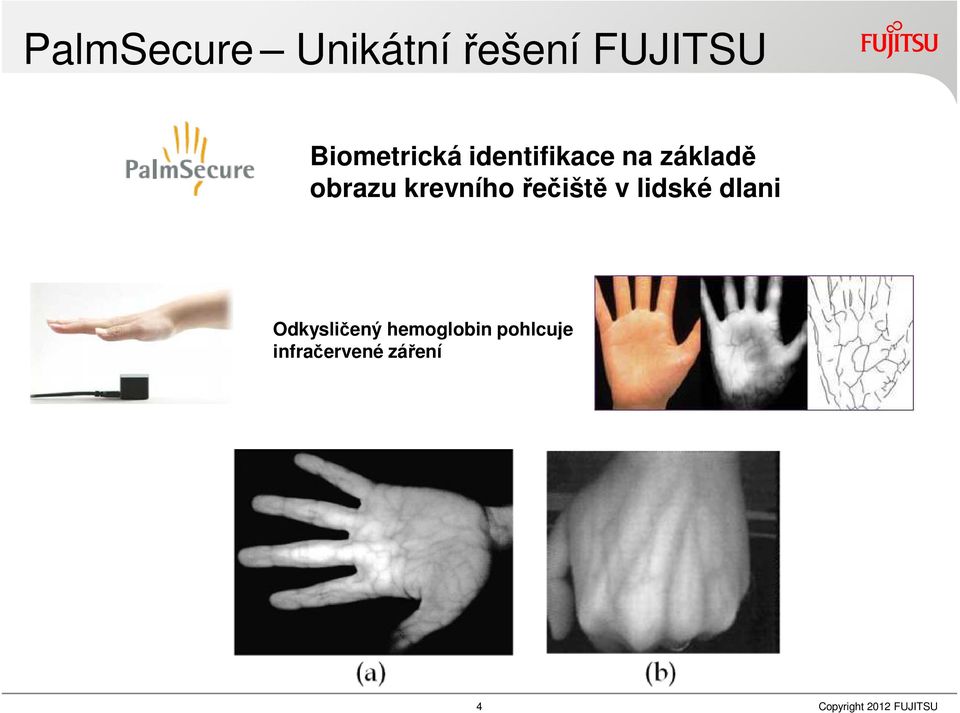 řečiště v lidské dlani Odkysličený hemoglobin