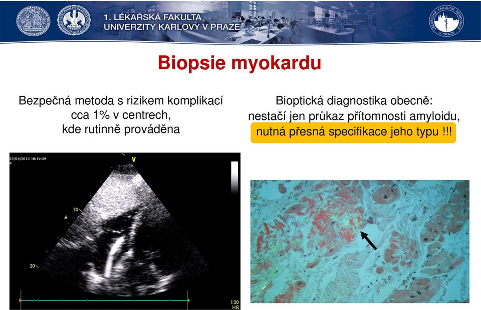 prováděna Bioptická diagnostika obecně: nestačí