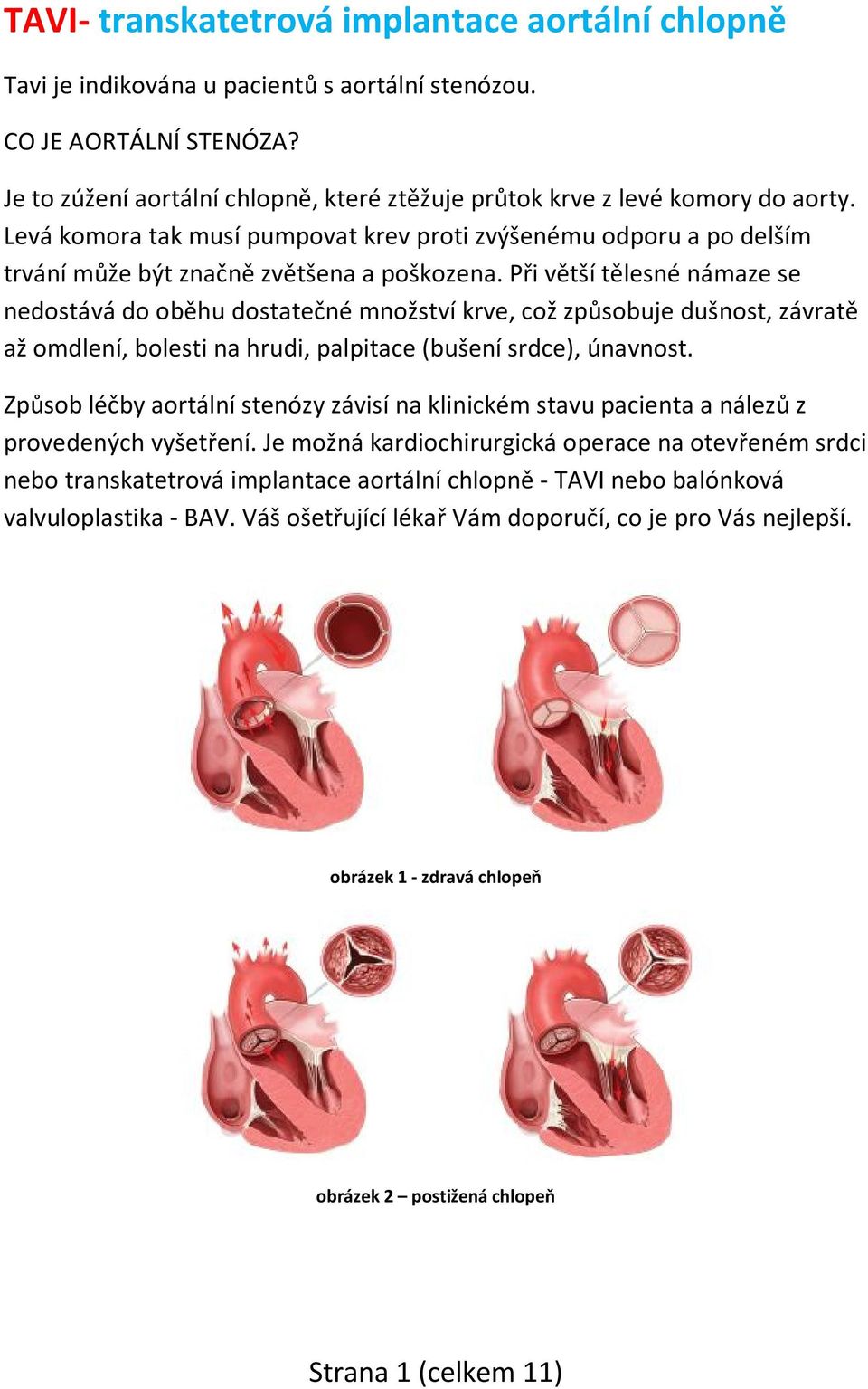 Při větší tělesné námaze se nedostává do oběhu dostatečné množství krve, což způsobuje dušnost, závratě až omdlení, bolesti na hrudi, palpitace (bušení srdce), únavnost.