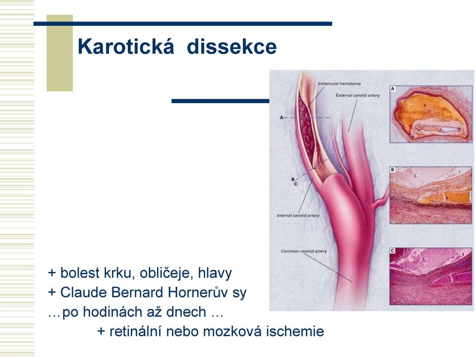 Hornerův sy po hodinách až dnech