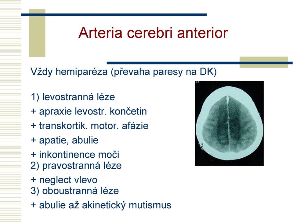 afázie + apatie, abulie + inkontinence moči 2) pravostranná léze +