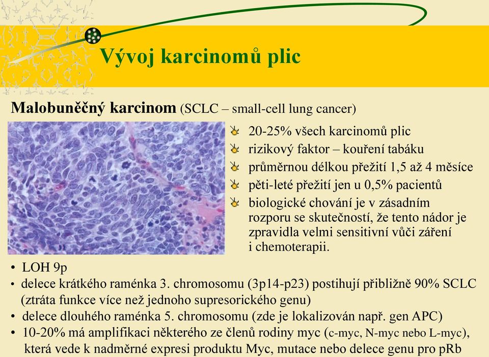 LOH 9p delece krátkého raménka 3. chromosomu (3p14-p23) postihují přibližně 90% SCLC (ztráta funkce více než jednoho supresorického genu) delece dlouhého raménka 5.