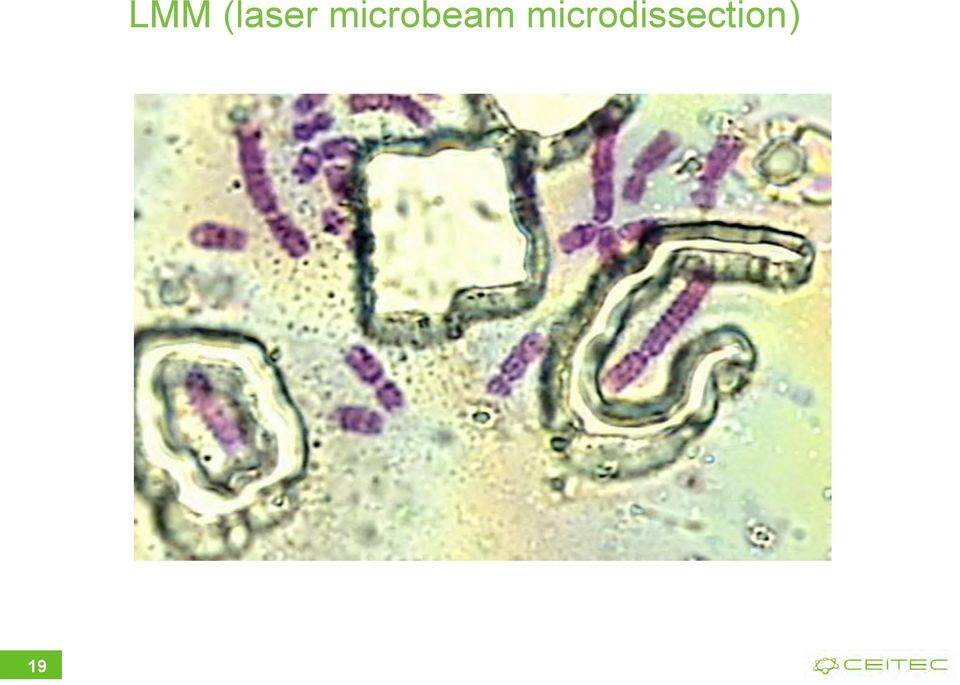 microbeam