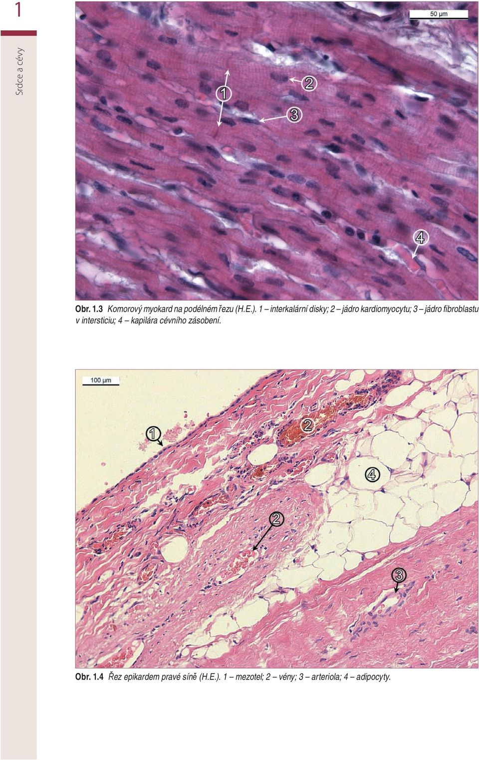 v intersticiu; 4 kapilára cévního zásobení. Obr. 1.