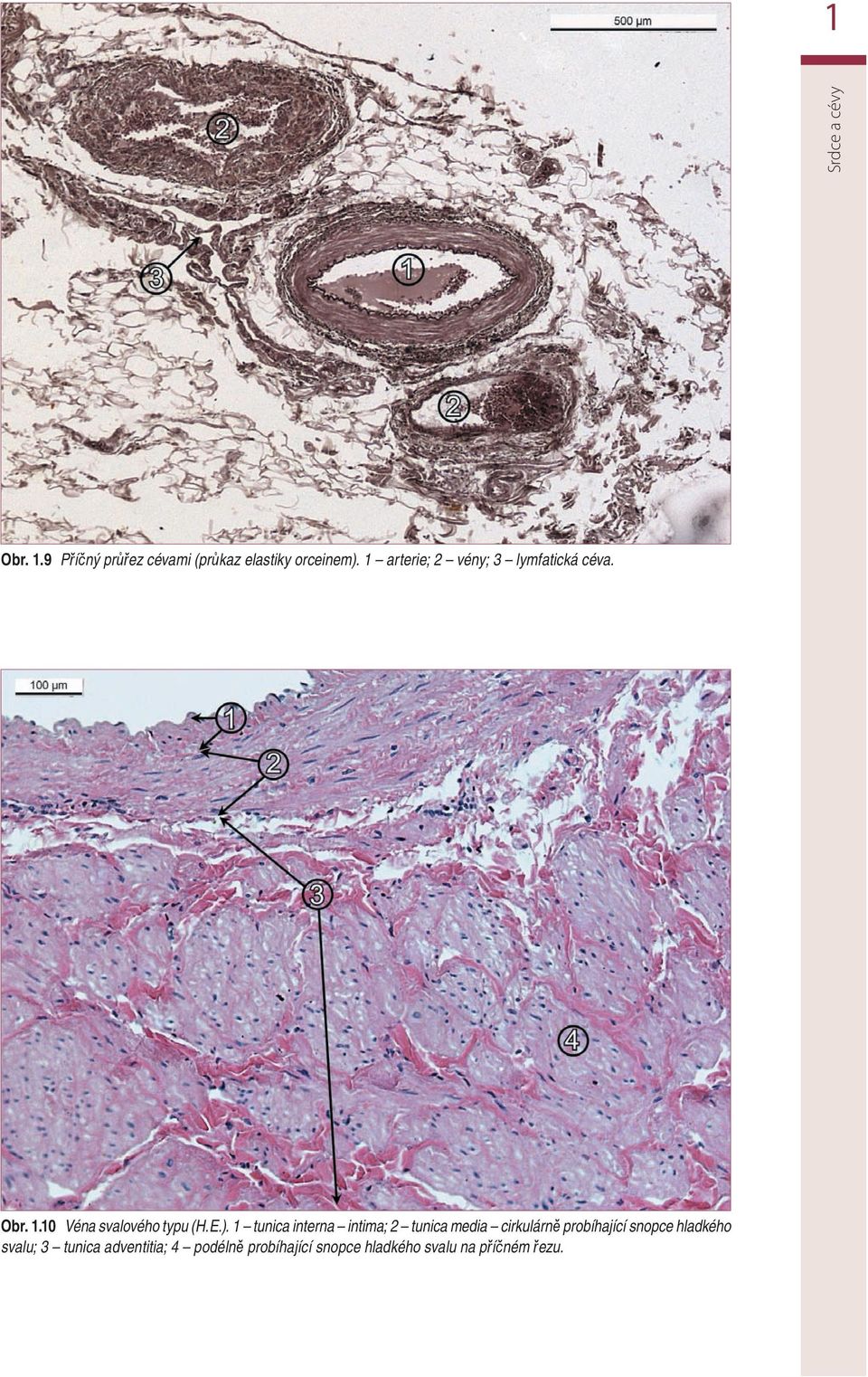 1 tunica interna intima; 2 tunica media cirkulárně probíhající snopce hladkého