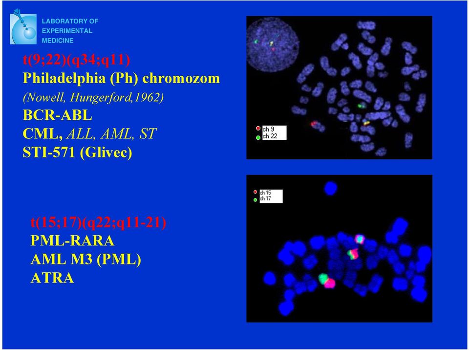 (Nowell, Hungerford,1962) BCR-ABL CML, ALL, AML,