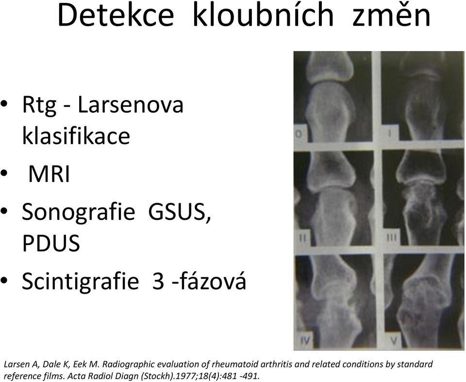 Radiographic evaluation of rheumatoid arthritis and related