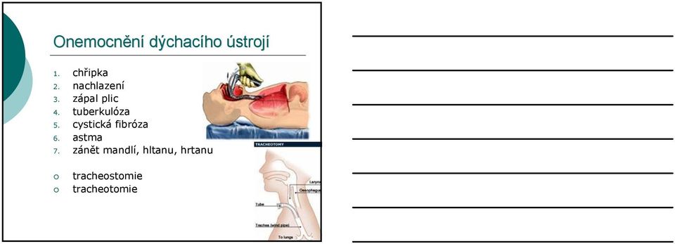 tuberkulóza 5. cystická fibróza 6. astma 7.