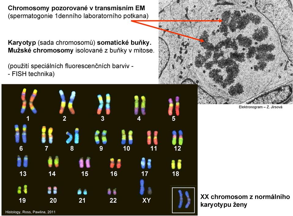 (použití speciálních fluorescenčních barviv - - FISH technika) Elektronogram Z.