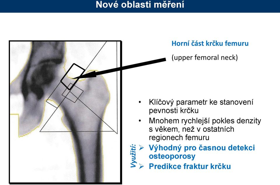 Mnohem rychlejší pokles denzity s věkem, než v ostatních