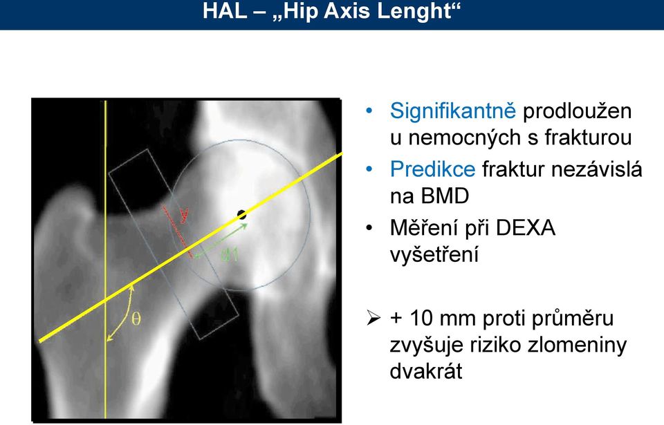 nezávislá na BMD Měření při DEXA vyšetření +