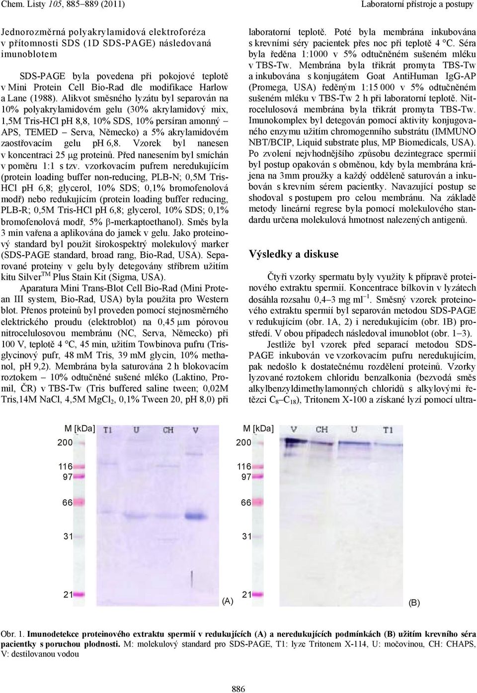 Alikvot směsného lyzátu byl separován na 10% polyakrylamidovém gelu (30% akrylamidový mix, 1,5M Tris-HCl ph 8,8, 10% SDS, 10% persíran amonný APS, TEMED Serva, Německo) a 5% akrylamidovém