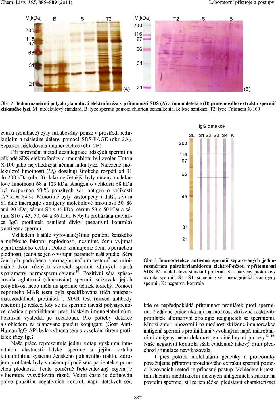 SDS-PAGE (obr. 2A). Separaci následovala imunodetekce (obr. 2B).