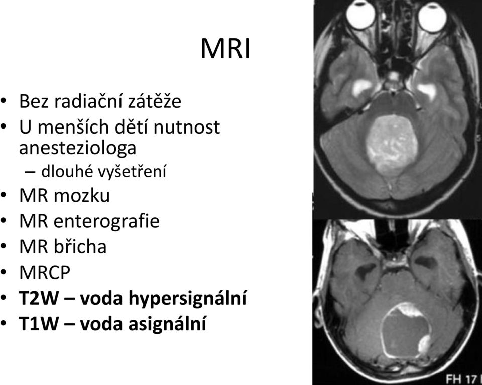 MR mozku MR enterografie MR břicha MRCP