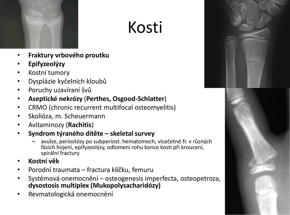 Scheuermann Avitaminozy (Rachitis) Syndrom týraného dítěte skeletal survey avulze, periostózy po subperiost. hematomech, vícečetné fr.