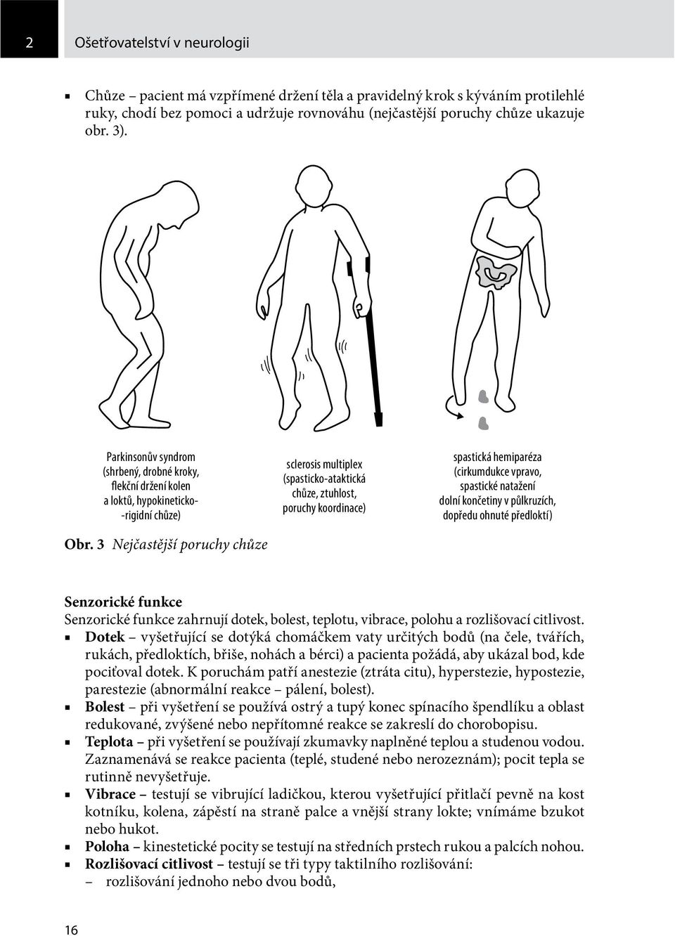 3 Nejčastější poruchy chůze sclerosis multiplex (spasticko-ataktická chůze, ztuhlost, poruchy koordinace) spastická hemiparéza (cirkumdukce vpravo, spastické natažení dolní končetiny v půlkruzích,