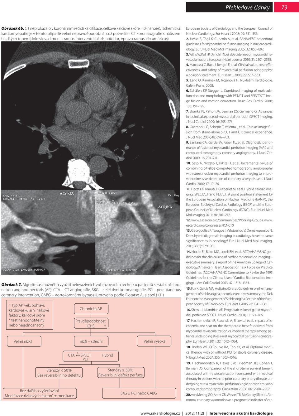 circumfelxus) Obrázek 7. Algoritmus možného využití neinvazivních zobrazovacích technik u pacientů se stabilní chronickou anginou pectoris (AP).