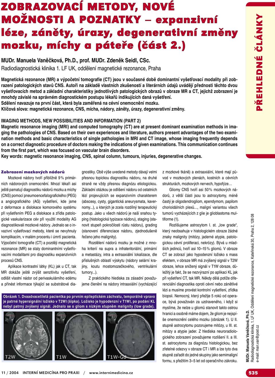 LF UK, oddělení magnetické rezonance, Praha Magnetická rezonance (MR) a výpočetní tomografie (CT) jsou v současné době dominantní vyšetřovací modality při zobrazení patologických stavů CNS.