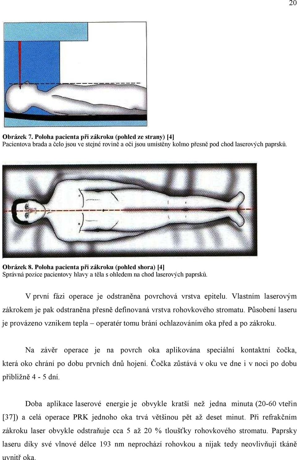 Vlastním laserovým zákrokem je pak odstraněna přesně definovaná vrstva rohovkového stromatu. Působení laseru je provázeno vznikem tepla operatér tomu brání ochlazováním oka před a po zákroku.