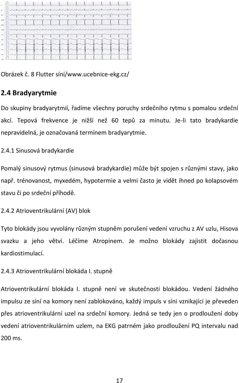 trénovanost, myxedém, hypotermie a velmi často je vidět ihned po kolapsovém stavu či po srdeční příhodě. 2.4.