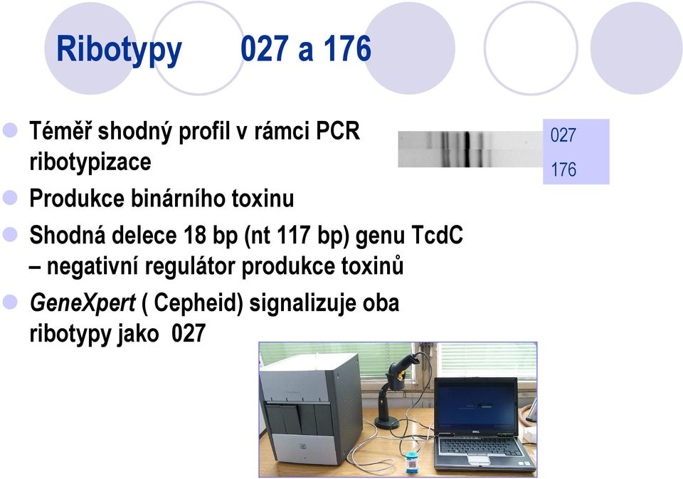 bp (nt 117 bp) genu TcdC negativní regulátor produkce