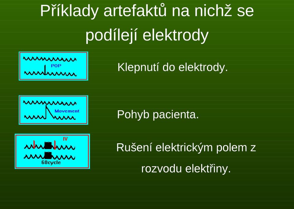 elektrody. Pohyb pacienta.