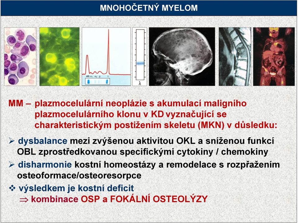 OKL a sníženou funkcí OBL zprostředkovanou specifickými cytokiny / chemokiny disharmonie kostní homeostázy