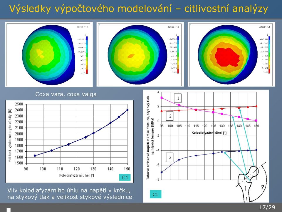 Vliv kolodiafyzárního úhlu na napětí v