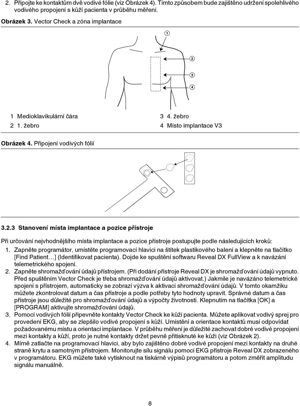 1. žebro 3 4. žebro 4 Místo implantace V3 Obrázek 4. Připojení vodivých fólií 3.2.