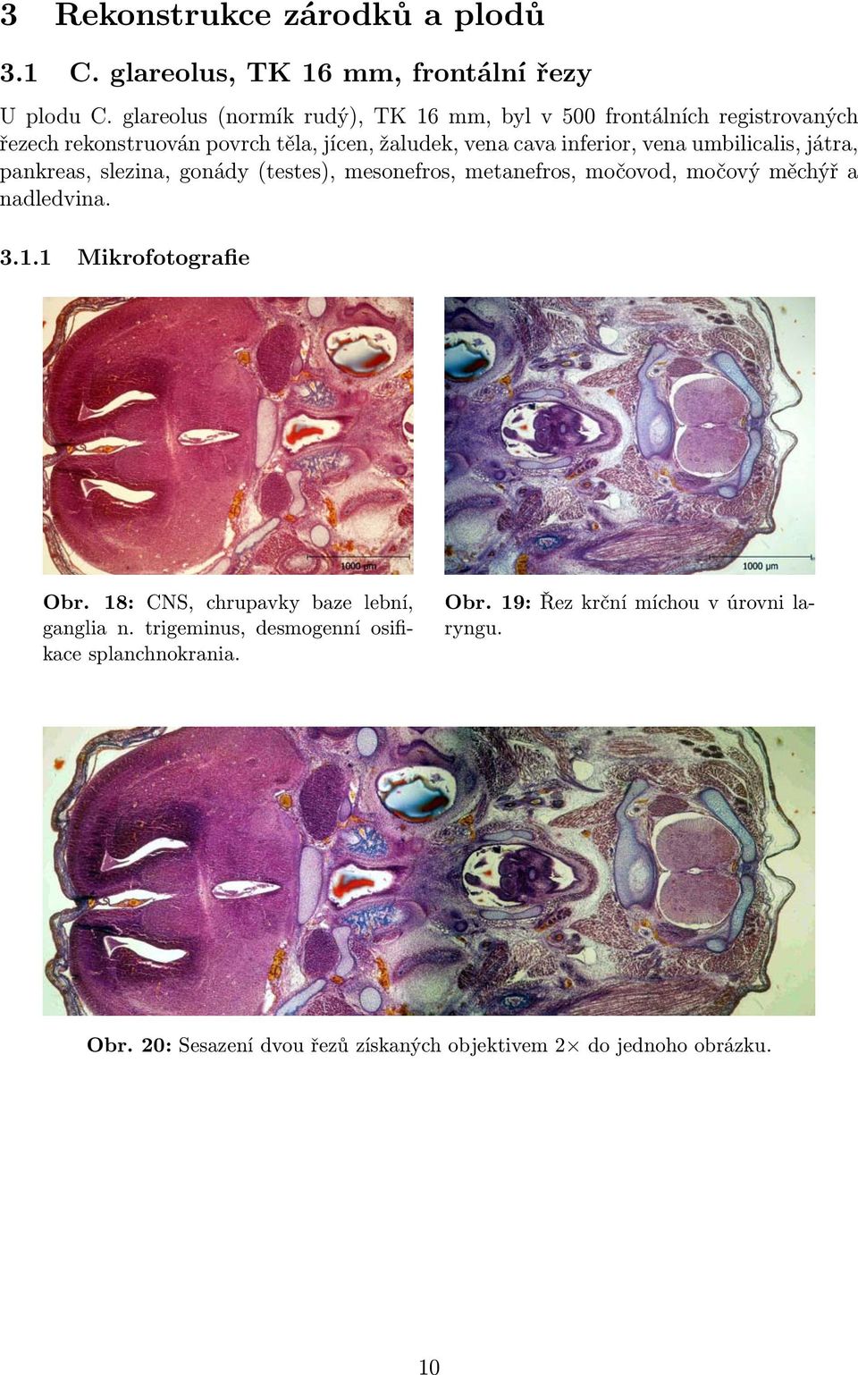 umbilicalis, játra, pankreas, slezina, gonády (testes), mesonefros, metanefros, močovod, močový měchýř a nadledvina. 3.1.1 Mikrofotografie Obr.