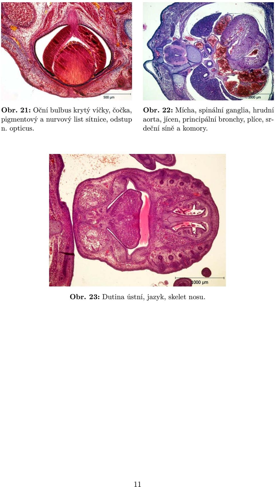 22: Mícha, spinální ganglia, hrudní aorta, jícen, principální