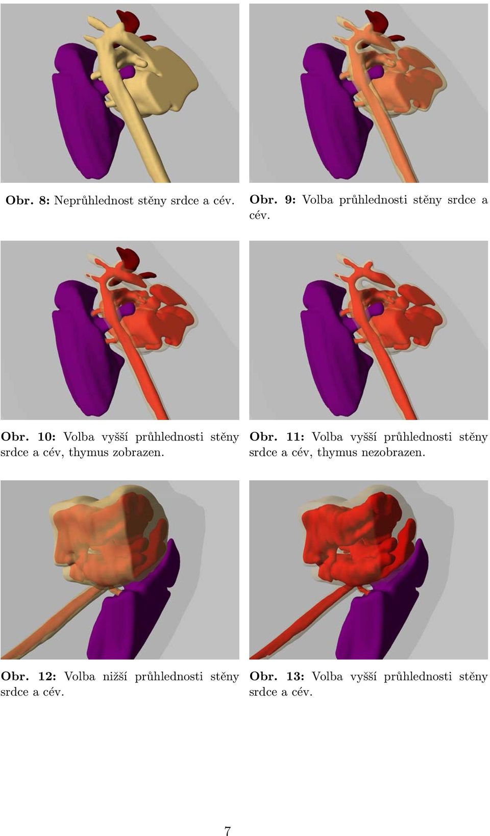 10: Volba vyšší průhlednosti stěny srdce a cév, thymus zobrazen. Obr.