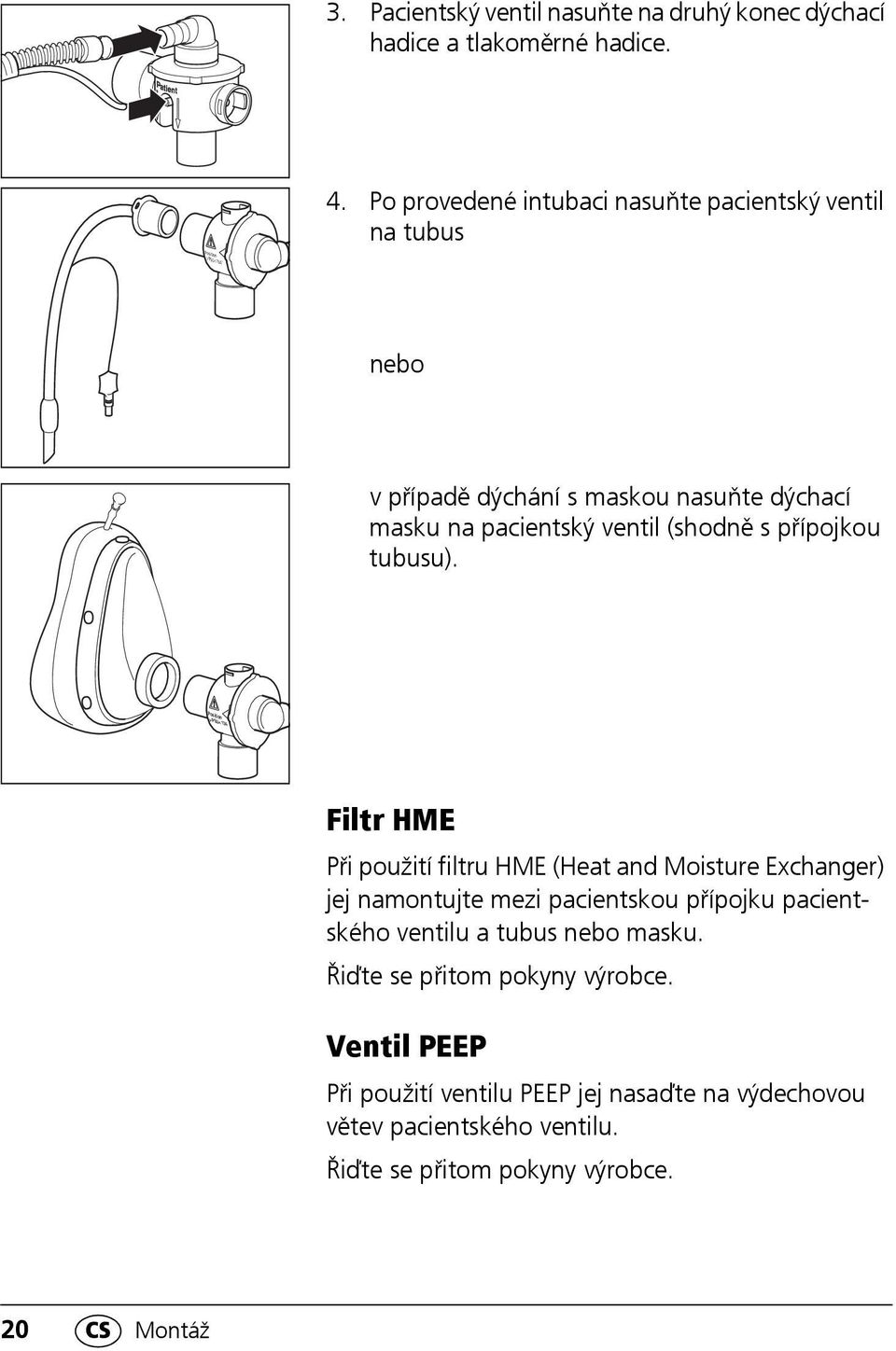 ventil (shodně s přípojkou tubusu).